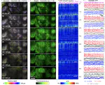 Rapid mesoscale volumetric imaging of neural activity with synaptic resolution