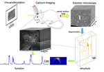 EASE: EM-Assisted Source Extraction from calcium imaging data