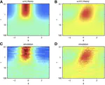 Impact of neuronal heterogeneity on correlated colored noise-induced synchronization